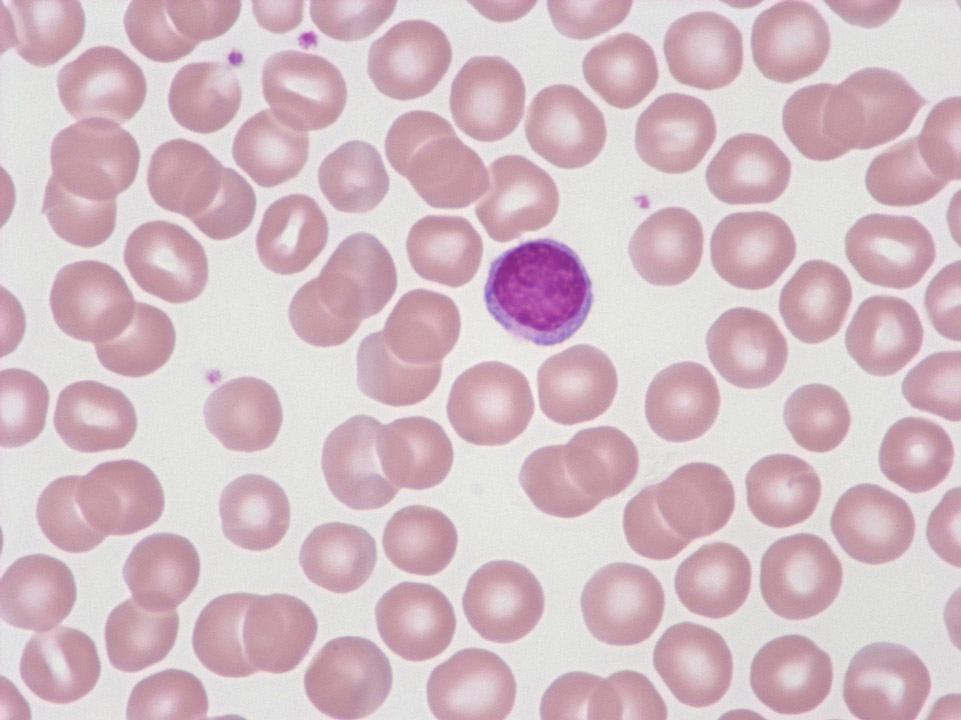 Globules rouges et  lymphocytes
