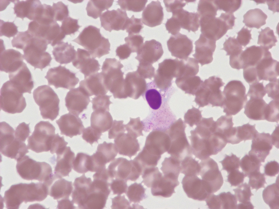 Granulocytes dégradés Granulocytes dégradés