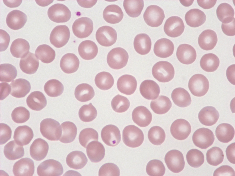 Globules rouges Globules rouges