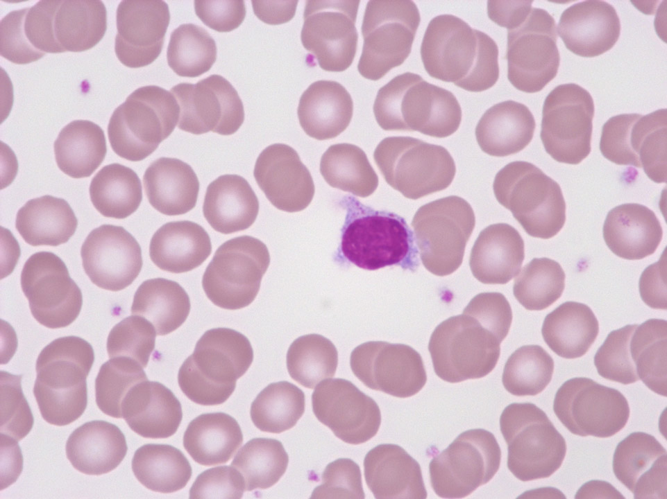 Tricholeucocyte Tricholeucocyte