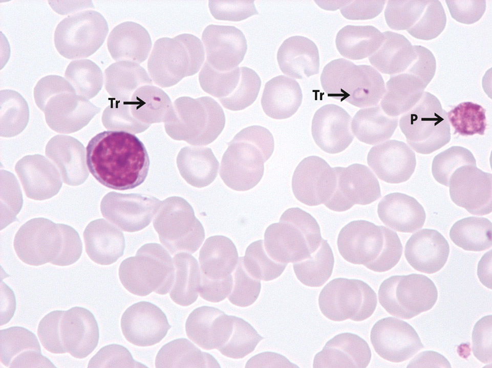 Trophozoïtes de Malaria tropica Trophozoïtes de Malaria tropica
